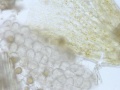 Chamomile inner & outer epidermis, 200x.jpg