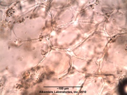 Phyllanthus emblica - Alkemists Laboratories1.jpg