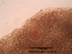 Ocimum tenuiflorum glandular trichome showing multicellular head.png