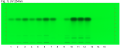 Pimpinella anisum Aniseed-UV 254 nm-hptclc-association.png