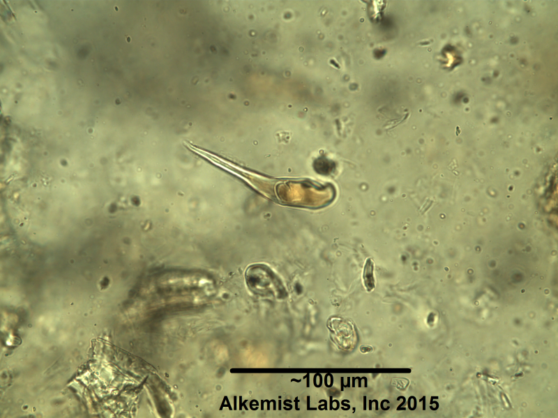 File:Terminalia bellerica covering trichomes showing tannic masses at the base.png