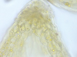 Chamomile outer epidermis with oil, 400x.jpg