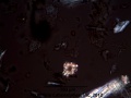 Eleutherococcus senticosus (Rupr. & Maxim.) -Araliaceae- Large rosettes of Calcium Oxalate.jpg