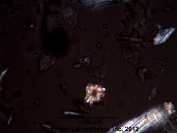Eleutherococcus senticosus (Rupr. & Maxim.) -Araliaceae- Large rosettes of Calcium Oxalate.jpg