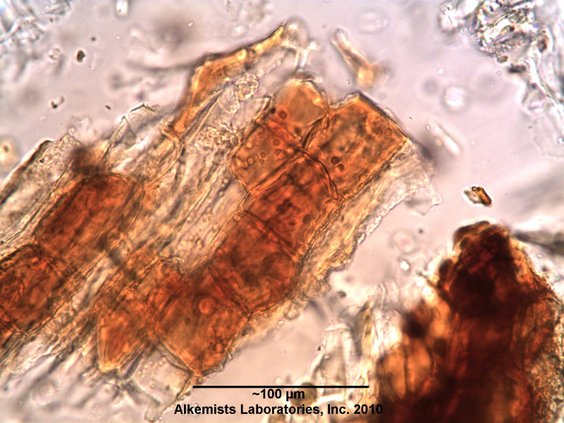 File:Alkemists Actaea racemosa brown suberized cells.png
