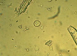 St johns wort pollen grain phytolab.jpg