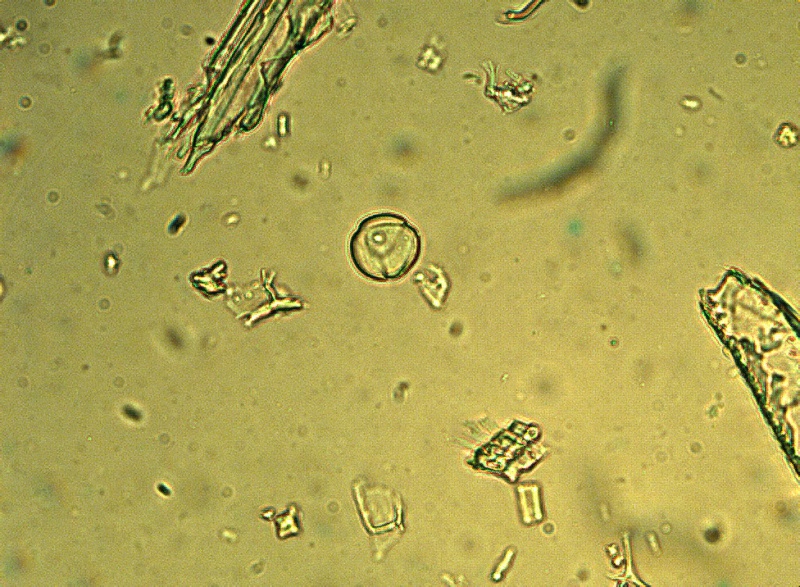 File:St johns wort pollen grain phytolab.jpg