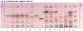 Amomum spp-Anisaldehyde reagent, white RT-hptlc-association.png