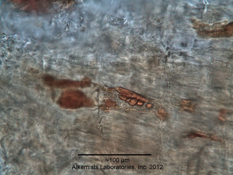 File:Echinacea purpurea (L.) Moench -Asteraceae--1.jpg