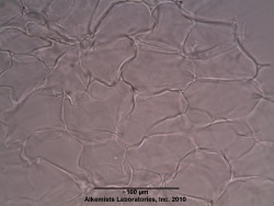 Allium sativum L. -Liliaceae- thin walled parenchyma showing intercellular spaces.jpg
