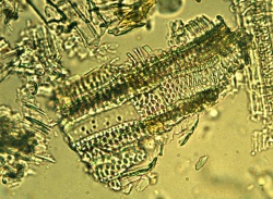 St johns wort tracheidal vessels with pitted walls phytolab.jpg