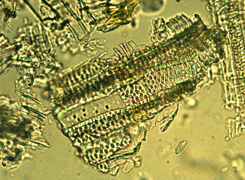 File:St johns wort tracheidal vessels with pitted walls phytolab.jpg