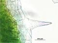 Cannabis sativa - OleMiss - Epidermal cells with cystolithic trichome.png