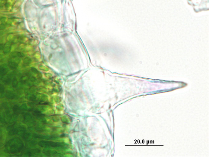 File:Cannabis sativa - OleMiss - Epidermal cells with cystolithic trichome.png