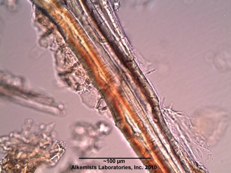 File:Eleutherococcus senticosus (Rupr. & Maxim.) -Araliaceae- thick-walled lignified fiber.jpg