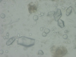 Glycyrrhiza Powder microscopy-starch granules - NR.jpg