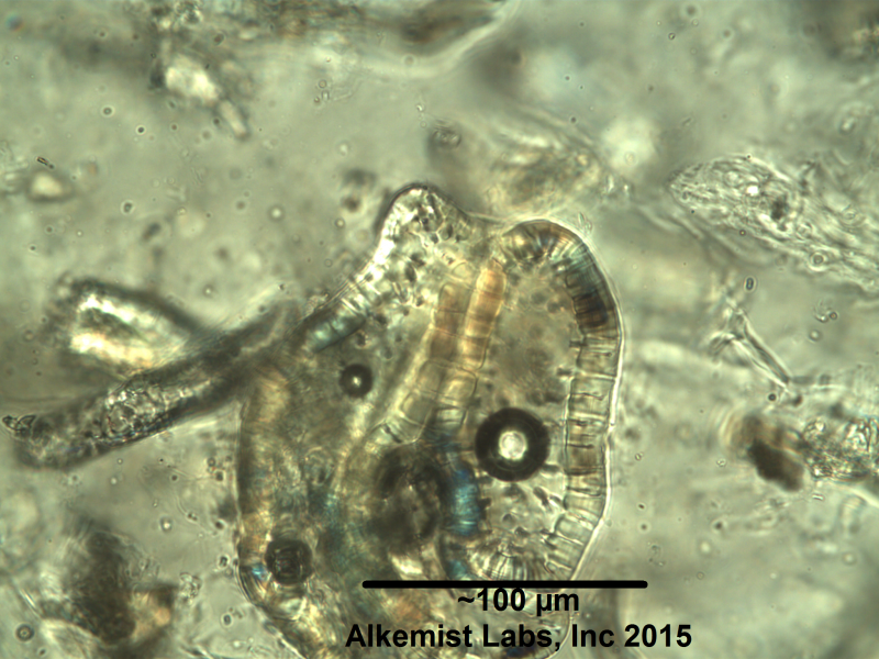 File:Terminalia bellerica a group of thick walled sclereids.png