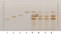 Camellia sinensis-hptlc-association.png