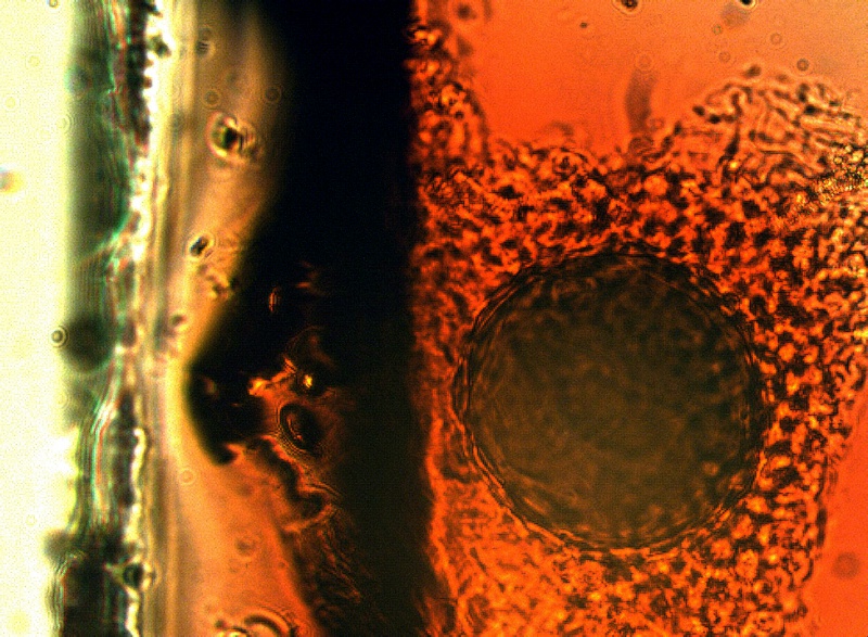 File:St johns wort hypericin gland phytolab.jpg