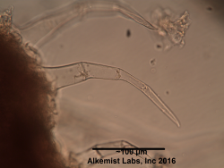 Ocimum tenuiflorum large multicellular covering trichome.png