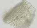 Glycyrrhiza Powder microscopy - vessels - NR.jpg