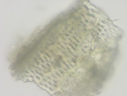 Glycyrrhiza Powder microscopy - vessels - NR.jpg