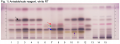 Lavandula latifolia oil-hptlc-association.png