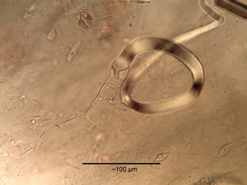File:Achillea millefolium trichome.jpg